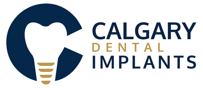 Calgary Dental Implants